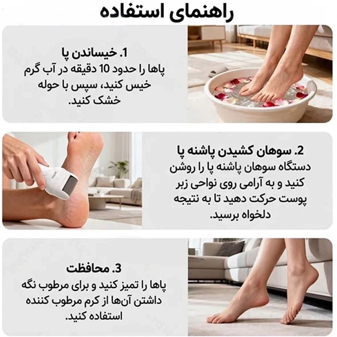 سنگ پا برقی شیائومی Rock2