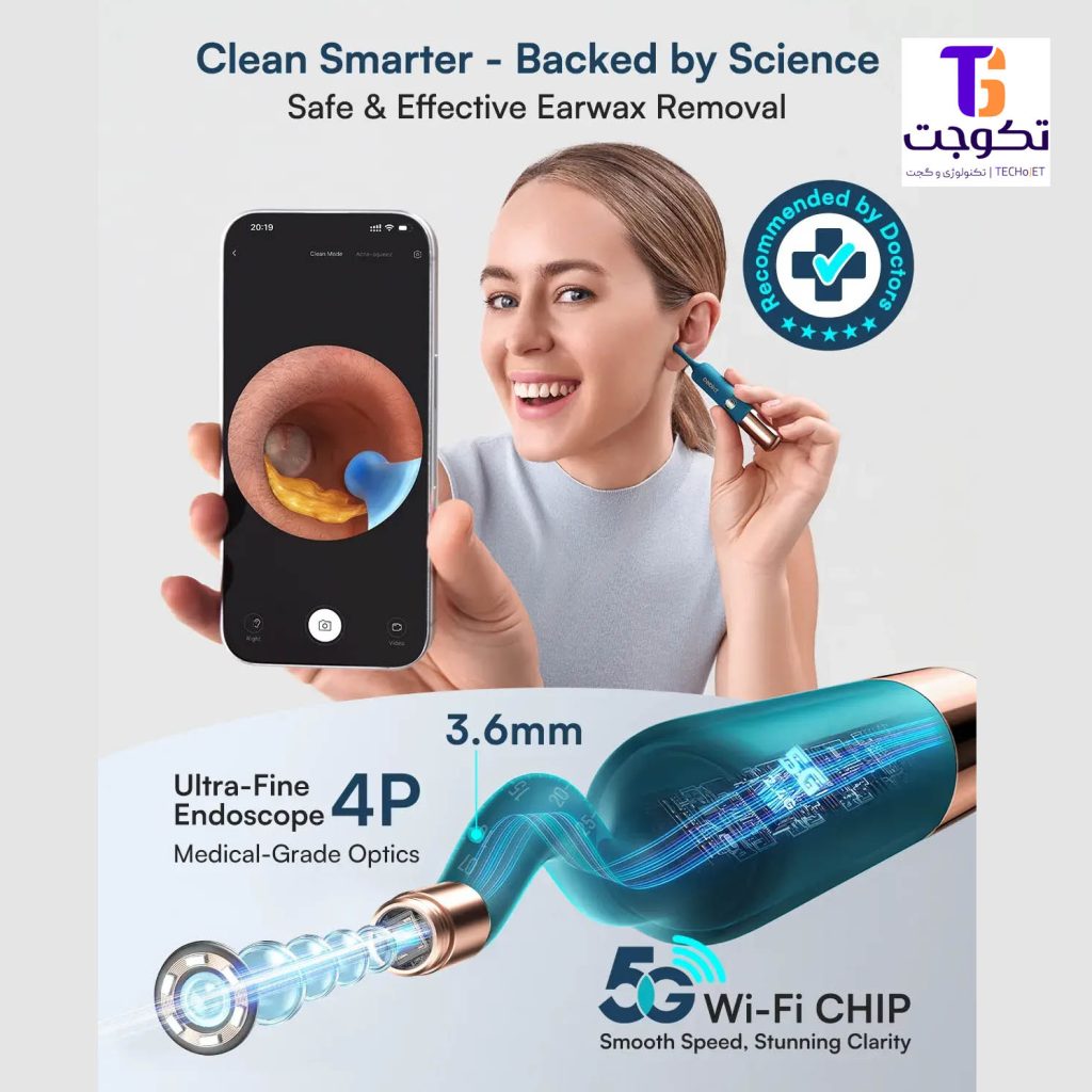 پک کامل گوش‌پاک‌کن بی‌برد Bebird Earsight Ultra