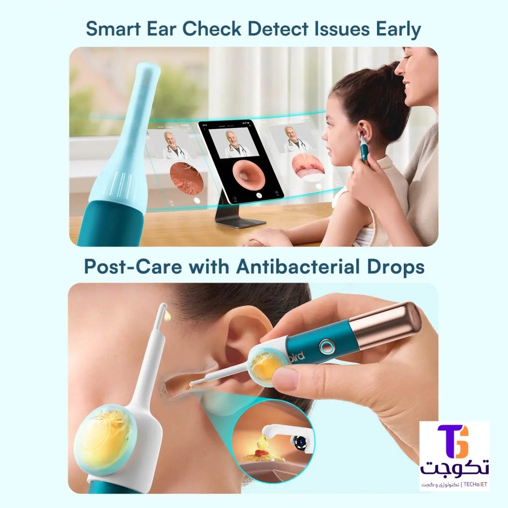 پک کامل گوش‌پاک‌کن بی‌برد Bebird Earsight Ultra