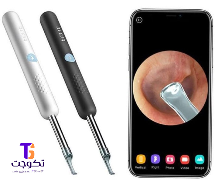 گوش پاک کن برقی ببیرد مدل Visual Ear cleaner (R1+)
