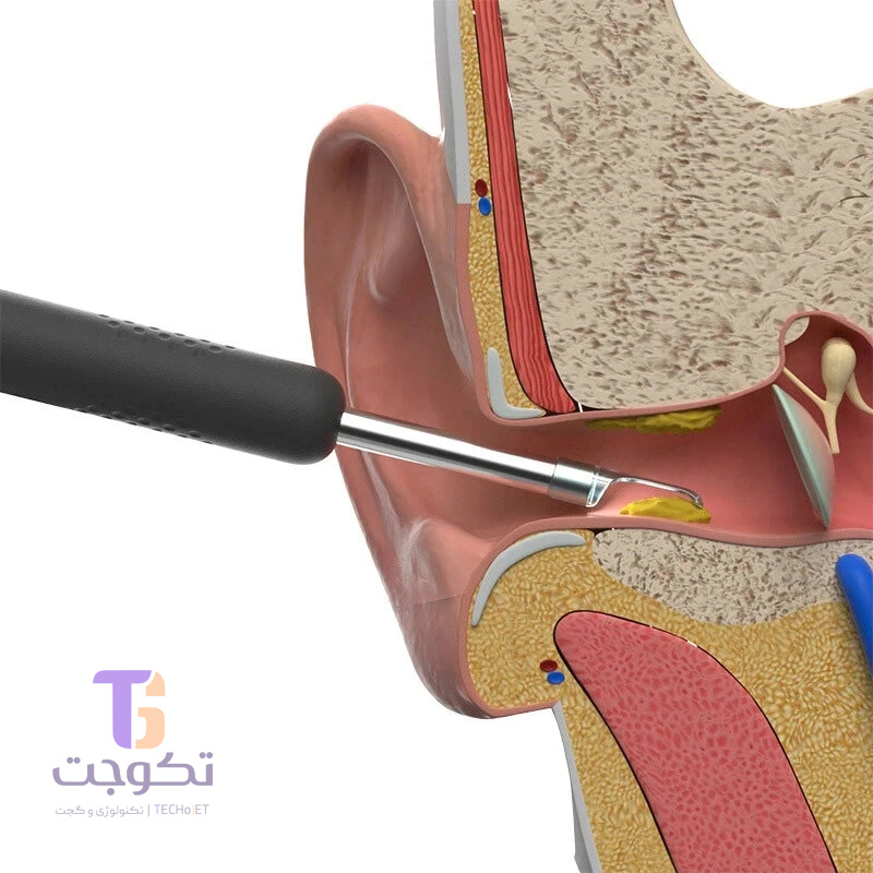 گوش پاک کن برقی ببیرد مدل Visual Ear cleaner (R1+)